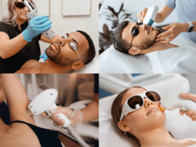 cost of laser hair removal